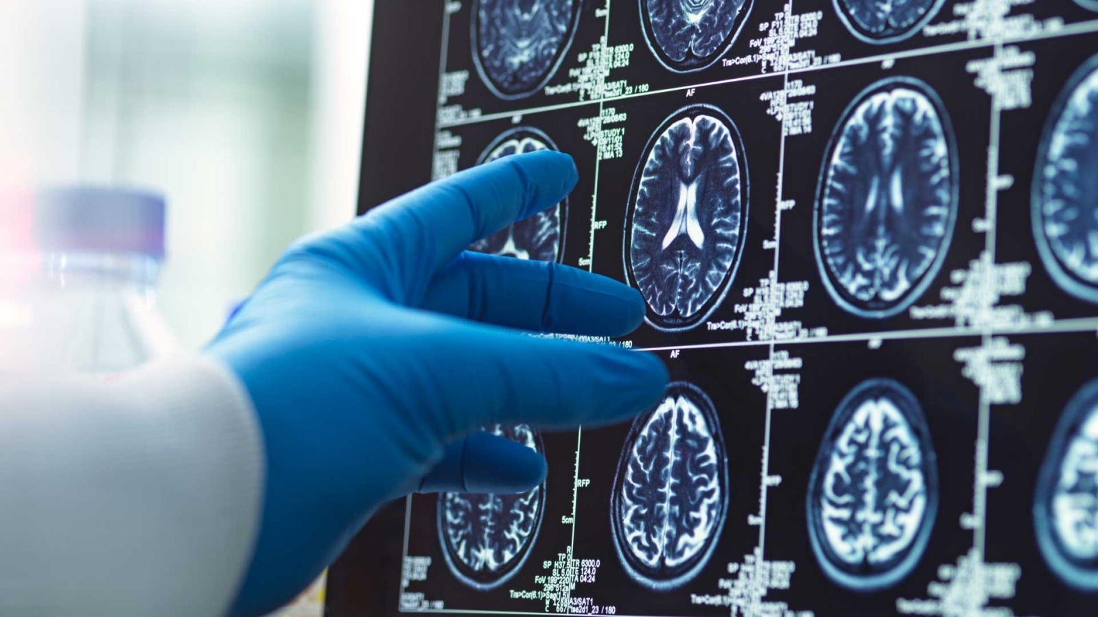 Doctor viewing brain scan image