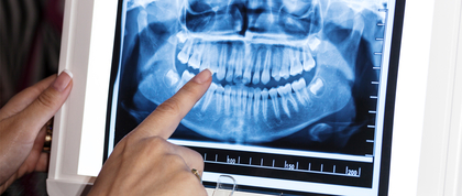 Dental x-ray